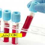 آزمایش خون CBC