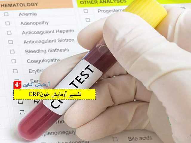 تفسیر آزمایش خون CRP
