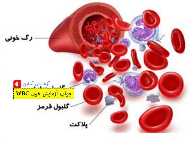 جواب آزمایش خون WBC