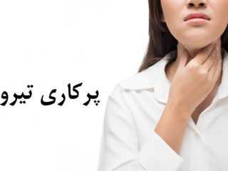 پرکاری تیروئید