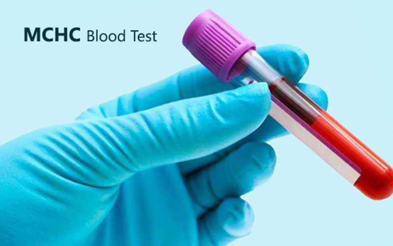 MCHC در آزمایش خون و تفسیر آن